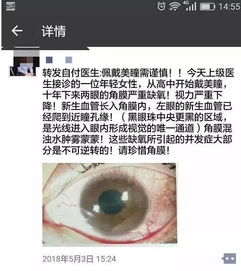 高中开始戴美瞳,10年后眼角膜成了这样 姑娘们看到这张图都吓坏了