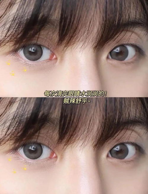 29.9秒5瓶 干眼人救星,蓝莓叶黄素滴眼液,温和滋养双眼,缓解眼疲劳 黄斑 红血丝 网易订阅