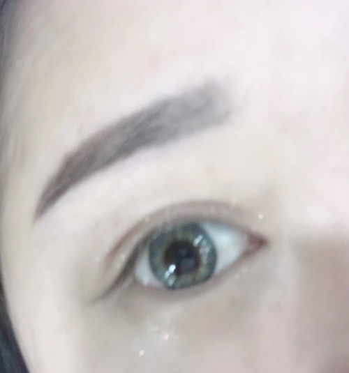 美瞳小科普 更新中,