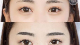 美瞳 –