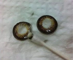 别让美瞳成为“隐形杀手” 警惕美丽背后的视力危机